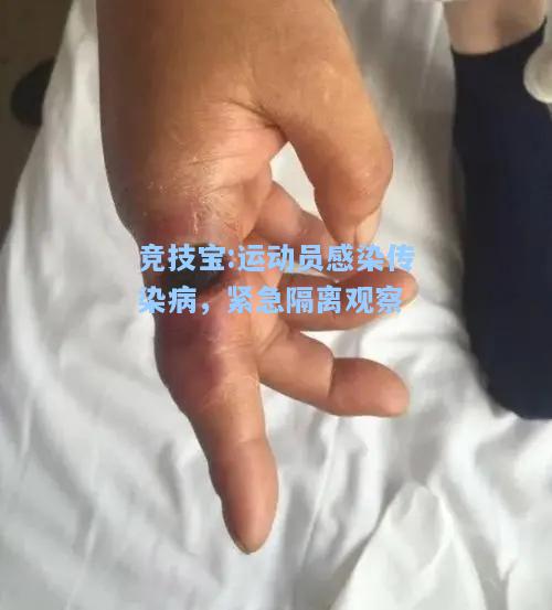 竞技宝:运动员感染传染病，紧急隔离观察